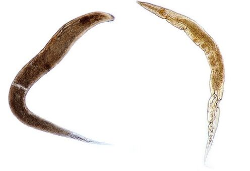 human parasites worms