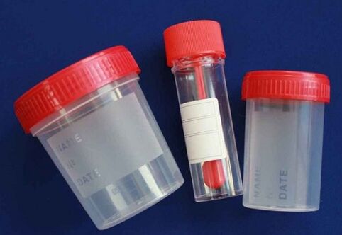 parasite test vials